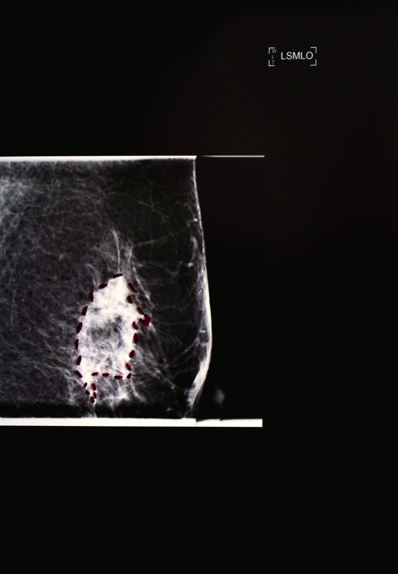 Sunaina Bhalla, Mammogram Series, Incursions, Incisions and Transgressions #Liv, 2020