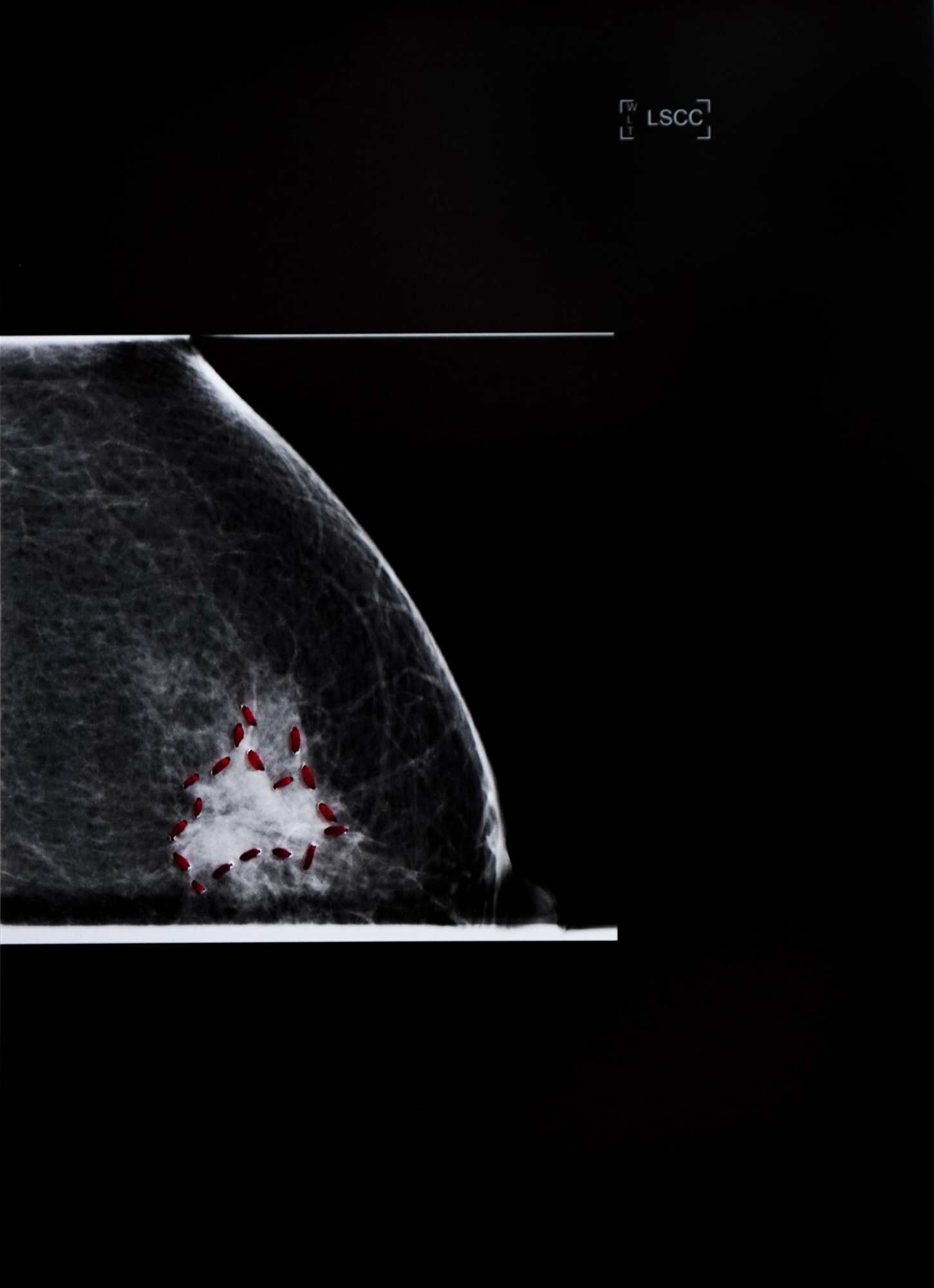 Sunaina Bhalla, Mammogram Series, Incursions, Incisions and Transgressions #Liii, 2020