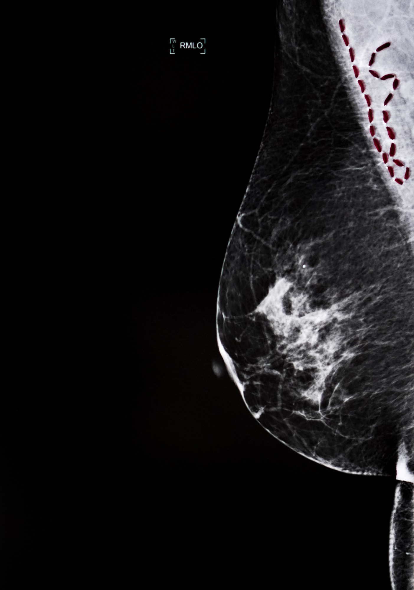 Sunaina Bhalla, Mammogram Series, Incursions, Incisions and Transgressions #Rvi, 2020