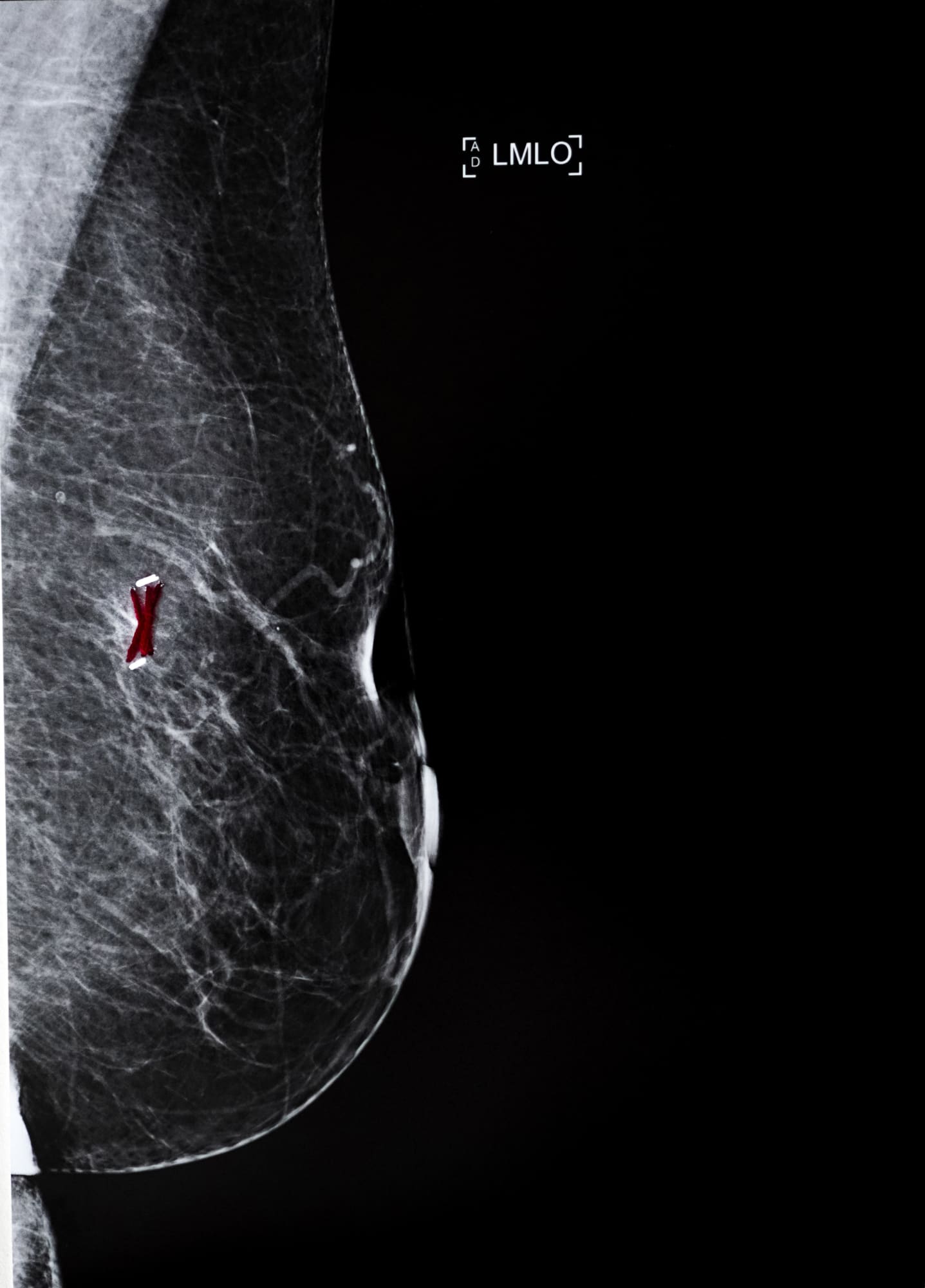 Sunaina Bhalla, Mammogram Series, Incursions, Incisions and Transgressions #Lvi, 2020