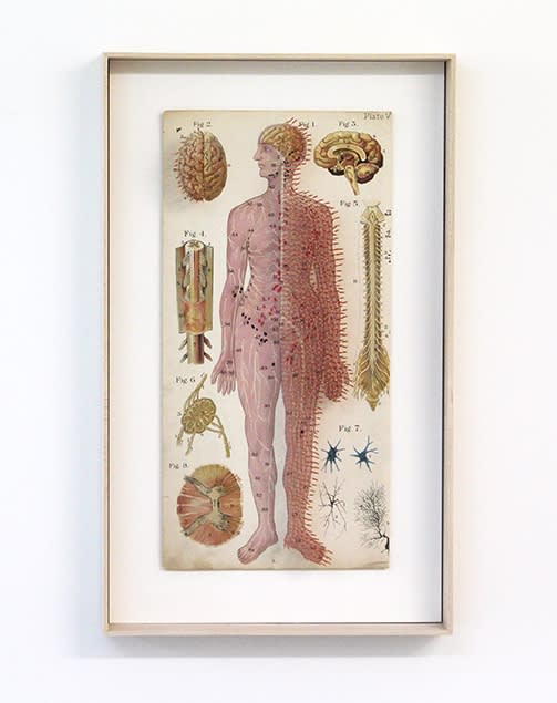 Prune Nourry Etrange planche anatomique #11 Reflexology Print, Acupuncture Needles 54 x 32,5 x 8