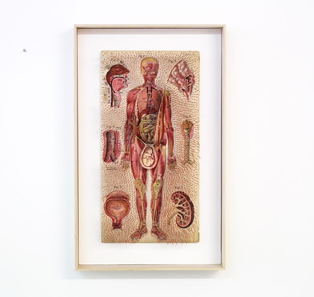Prune Nourry Etrange planche anatomique #12 Reflexology Print, Acupuncture Needles 21,5 x 43 x 5 cm