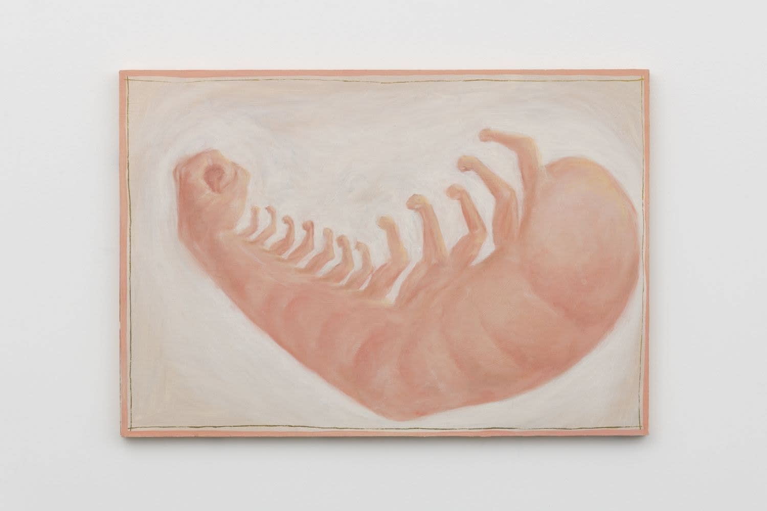 Tim Hawkinson, Martin (Muscle Flexing Shrimp Arm), 1995