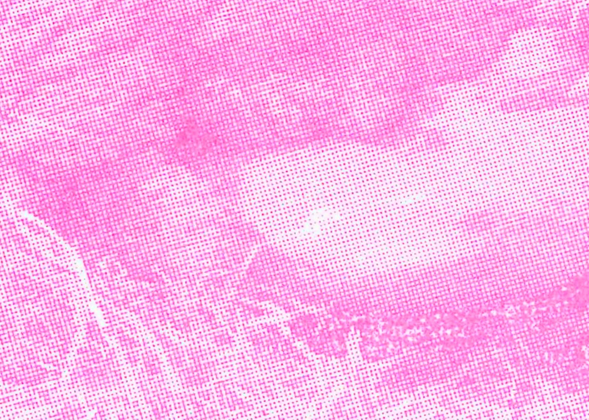 Selcuk Colakoglu, Birth III (through screen), 2022