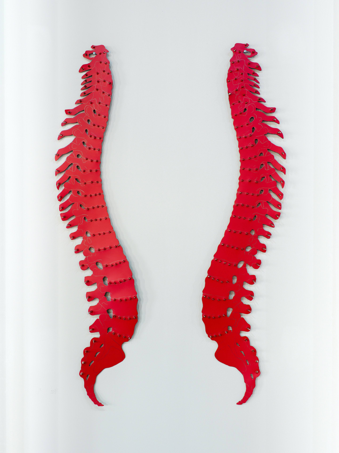 What Does "Unremarkable" Mean For My Bones? - vxy3xdh