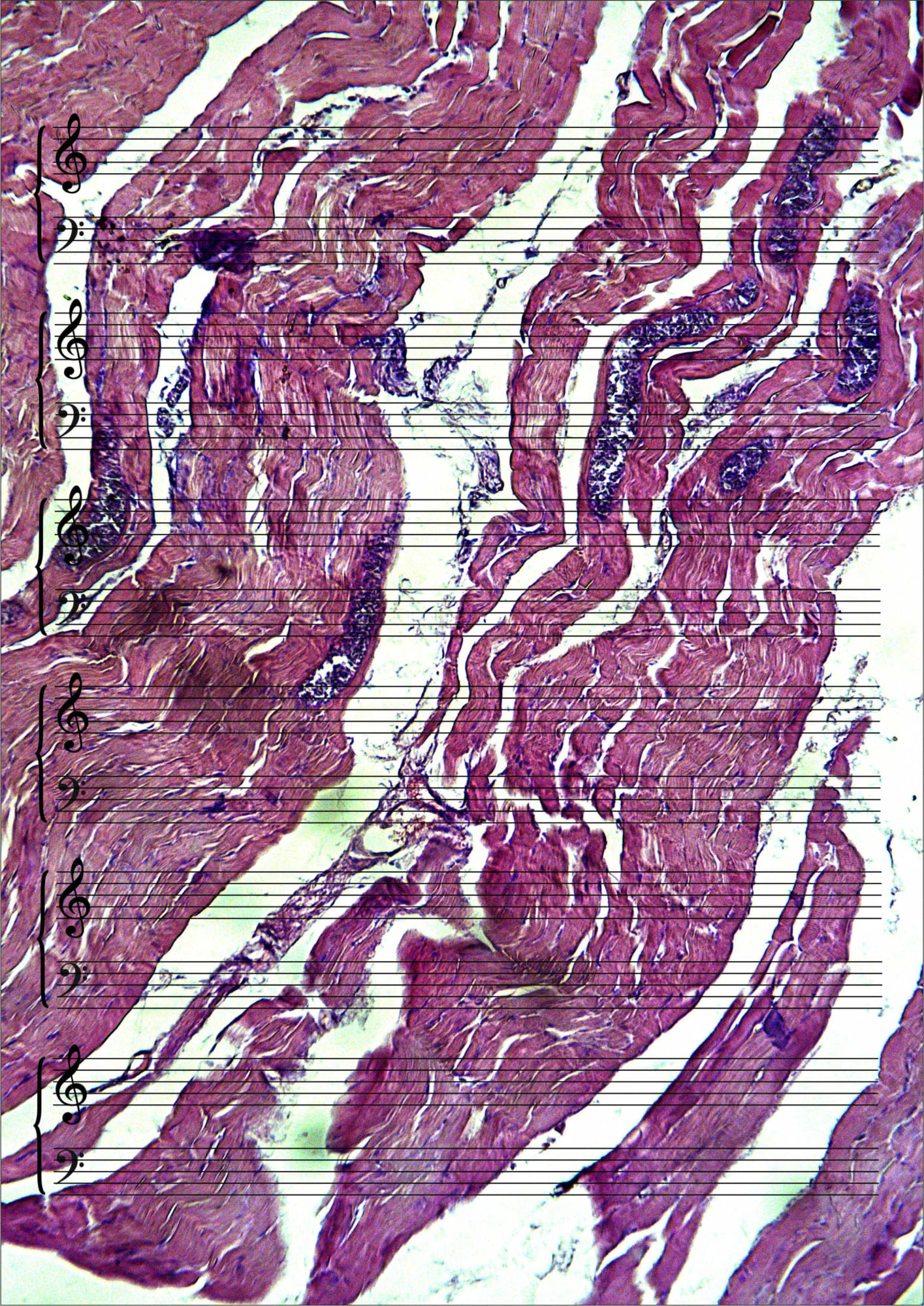 Farid Rasulov, Etli musiqi (Etli Mûsıkî) | Meat Music, 2020