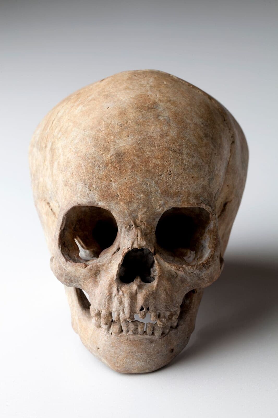 Cléa van der Grijn, Pediatric Bronze Skull