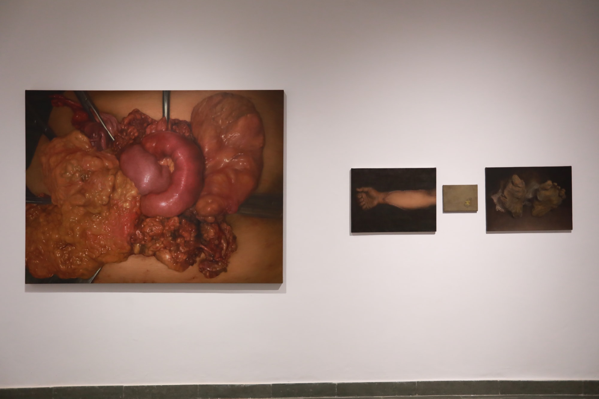 The Place called Body | Aditya Puthur