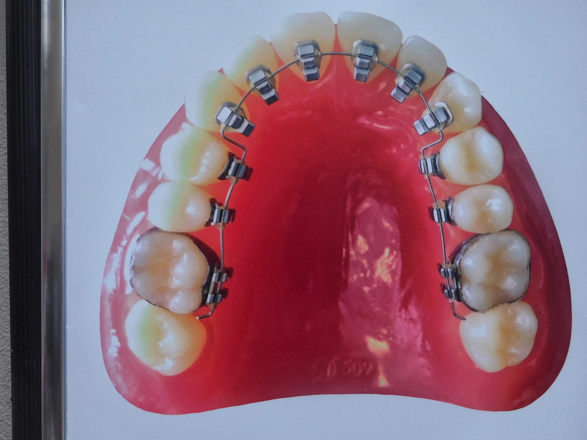 Daido Moriyama: Dog and Man