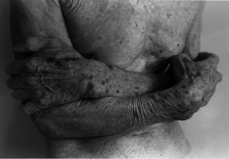 Ishiuchi Miyako, 1906 to the skin no. 17