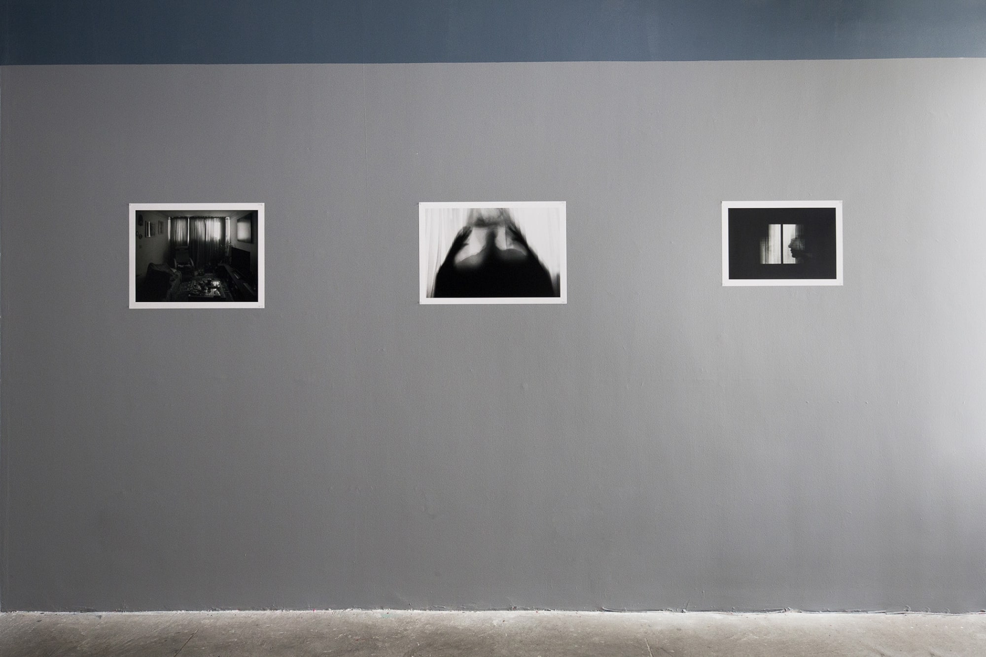 Niusha Hatefi | "Medulloblastoma"