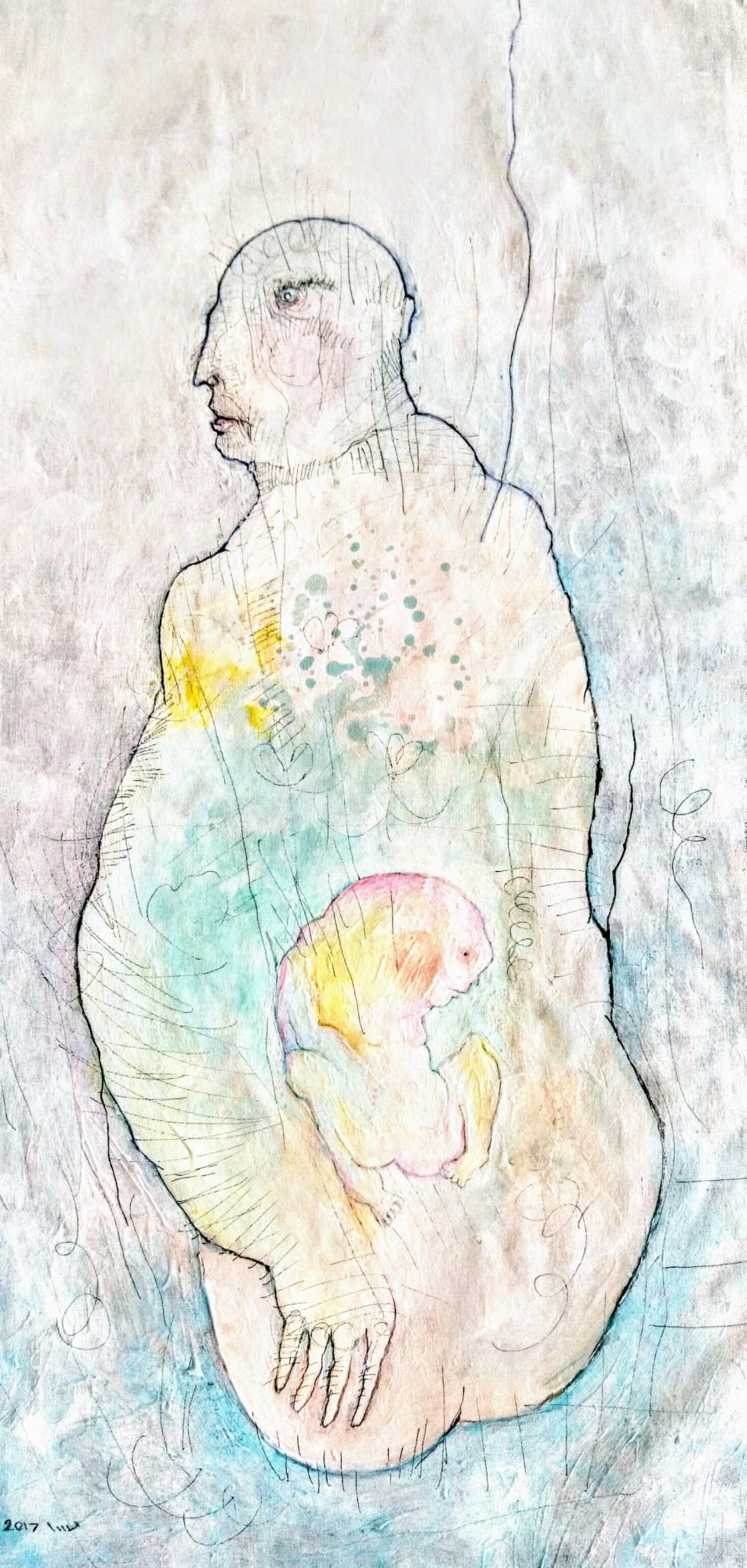 Mahsa Karimi | "Their Chronic Conditions"