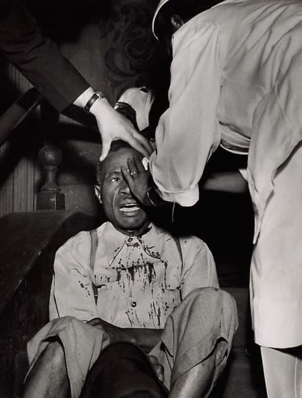 Gordon Parks Battered Man, 1943 gelatin silver print 20 x 16 inches Courtesy of the Gordon Parks Foundation ©The Gordon Parks Foundation