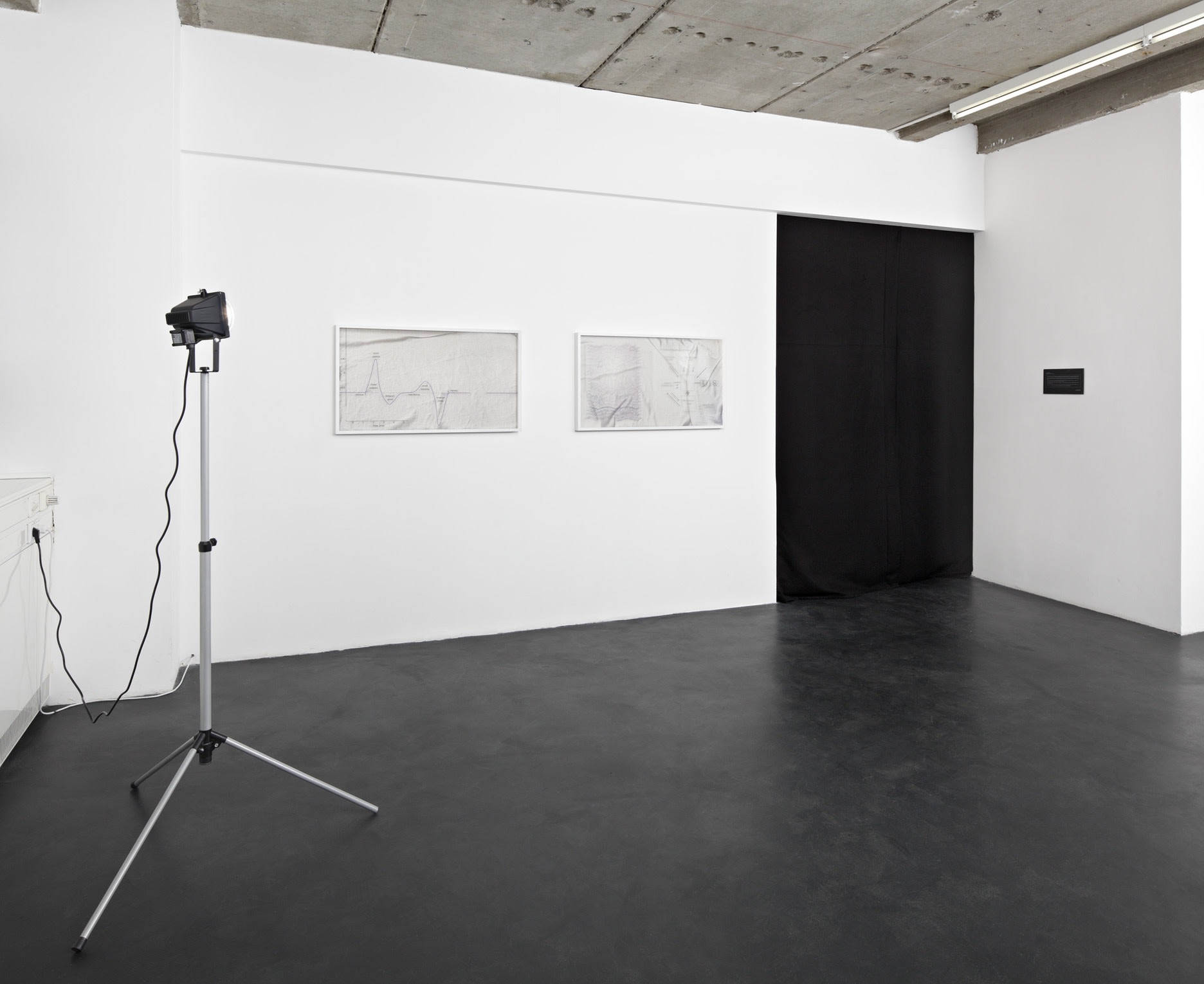 SIS : SOMATIC SYSTEMS