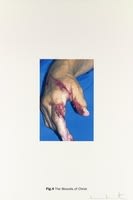 Damien Hirst