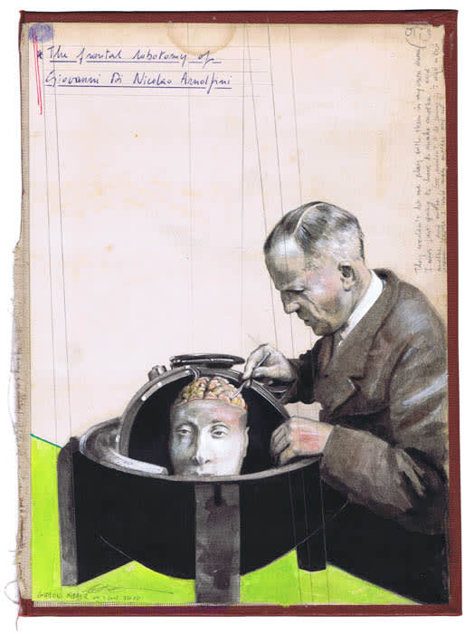 Gideon Kiefer, The Frontal Lobotomy Of Giovanni Di Nicolao Arnolfini 2012