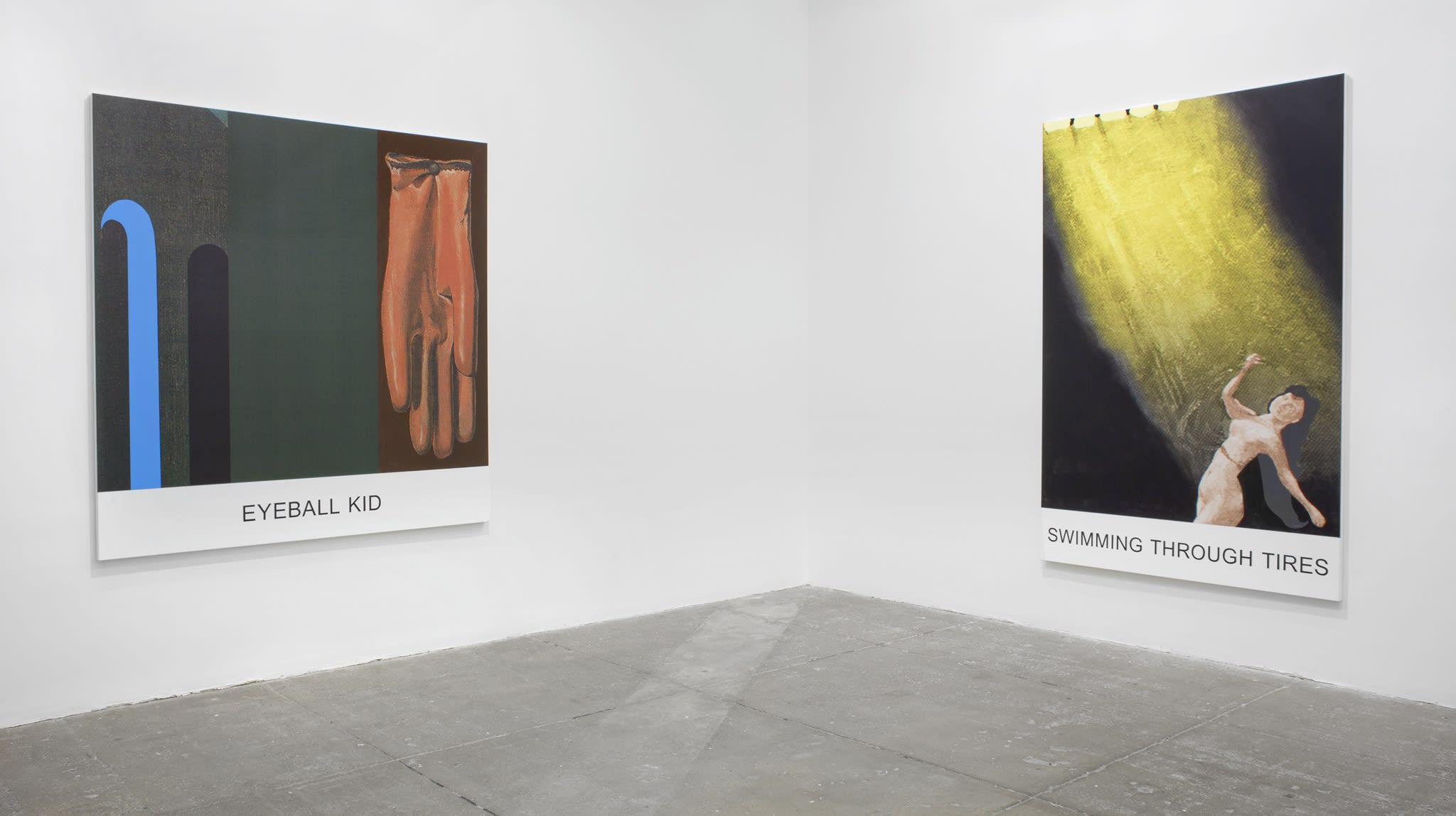Two prints on canvas with words underneath: 1- a dark brown glove, 2-a naked woman in a dark room turns away from the sunlight above her