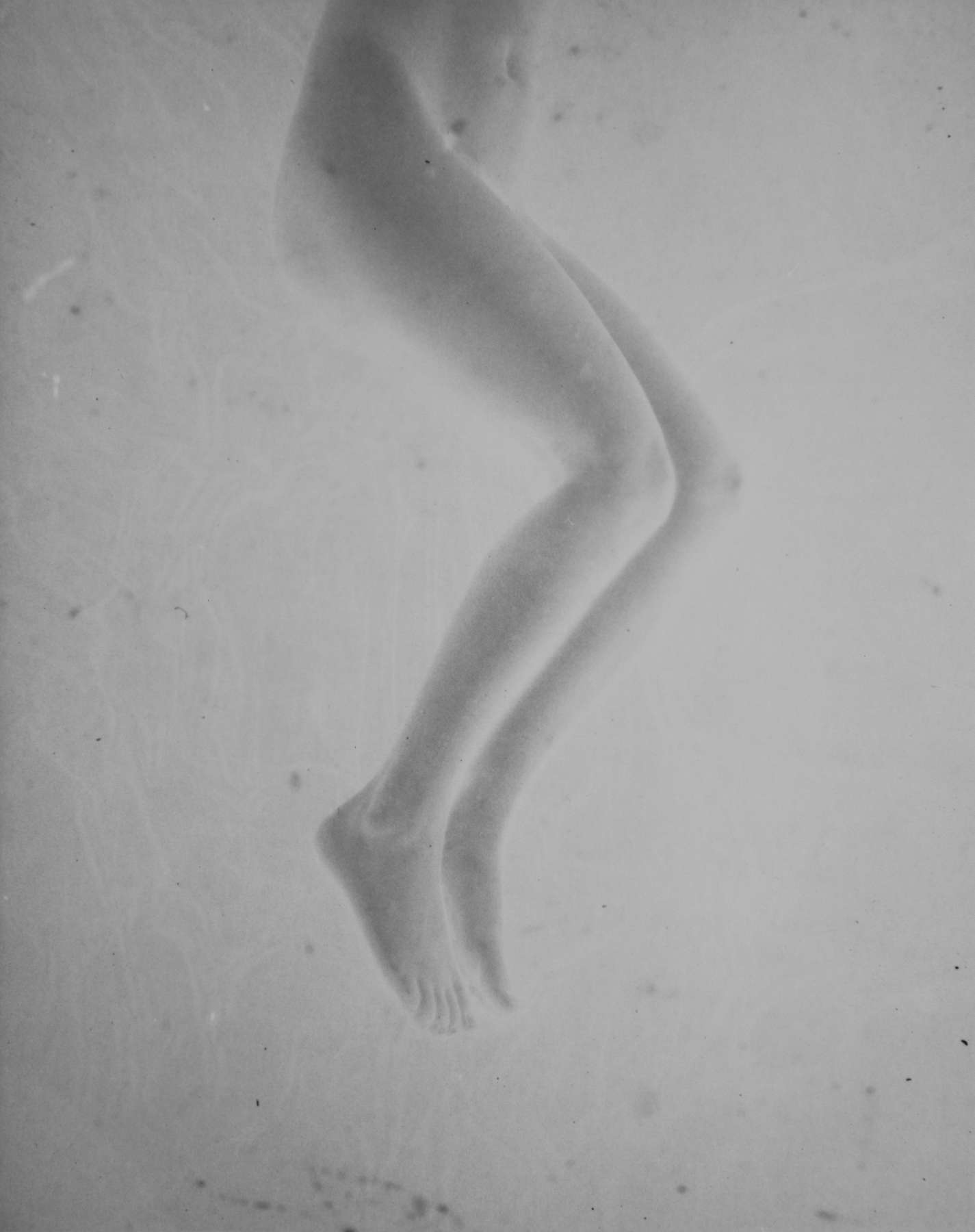 Untitled (Legs)