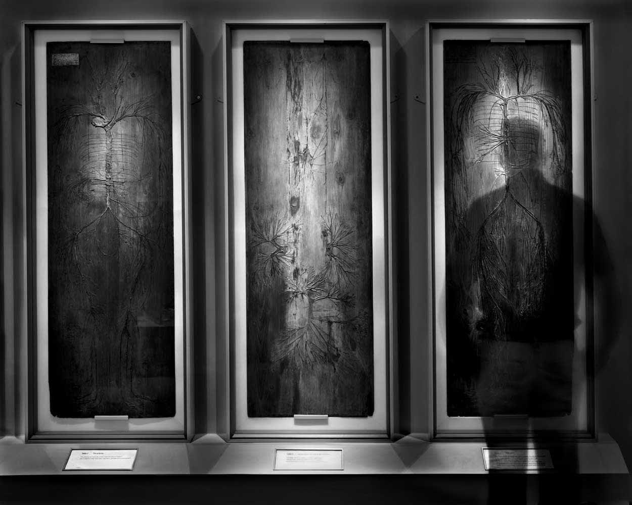 Arteries, Nerves and Veins, Royal Collage of Surgeons, London