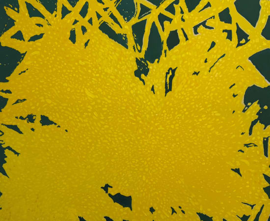 Paulina Domašauskaitė, Aš nupinsiu tau pienių vainiką / I will weave you a dandelion wreath, 2024