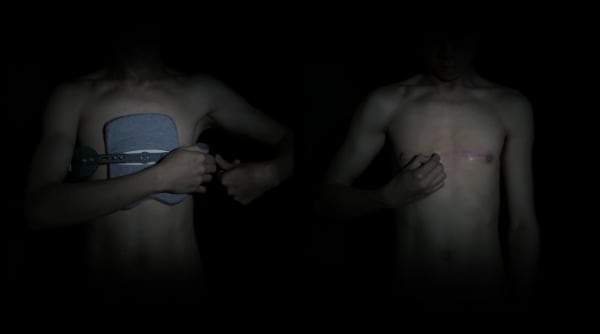 Yim Kei Tung, No Pain During Compression (2) & (3), 2019