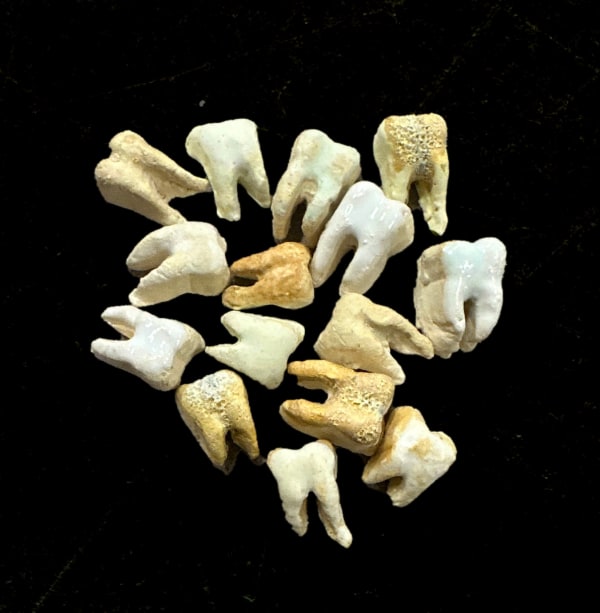 Janet Loren Hill, Loose Teeth, 2023