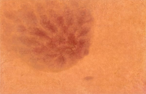 LEE Eunsil, Mastitis 넘치는 마음과 그렇지 못한 태도, 2025