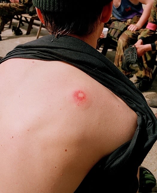 Anna Fox, Friendly Fire, 1989