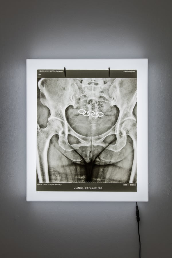 Jiang Li 蒋立, Five Rings 五环, 2008