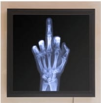 Nick Veasey, The Finger, 2014