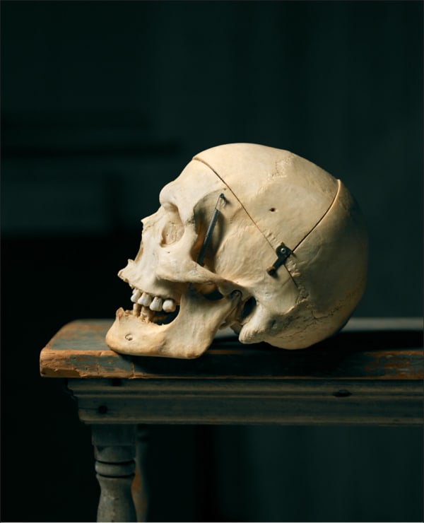 Laurie Rubin, Del Close's Skull