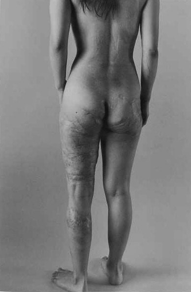 石内都 ISHIUCHI Miyako, Innocence#9, 1994 -