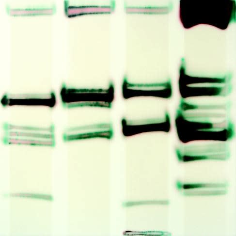 Jaq Chartier, Green O w/ 4 Lanes, 2009