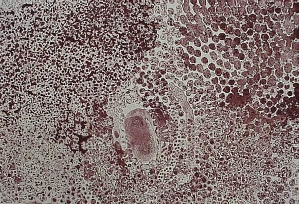 Lucy Yukenbarri, Winpurpurla , 2002