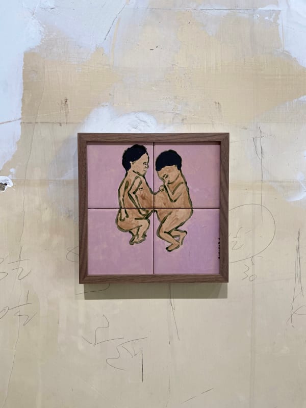 Cassi Namoda, Conjoined Twins (Fetal), 2021