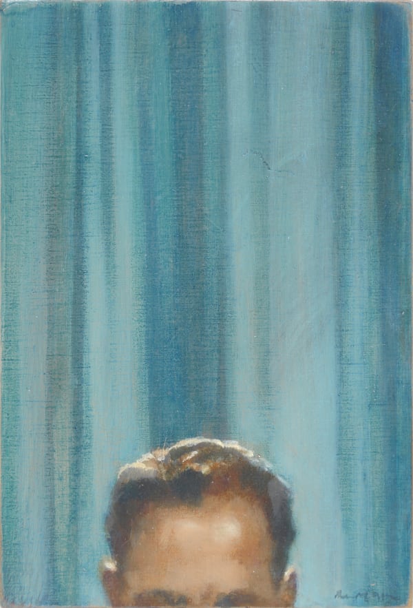 A man’s head from eyebrows and ears up is visible against a blue striped background.