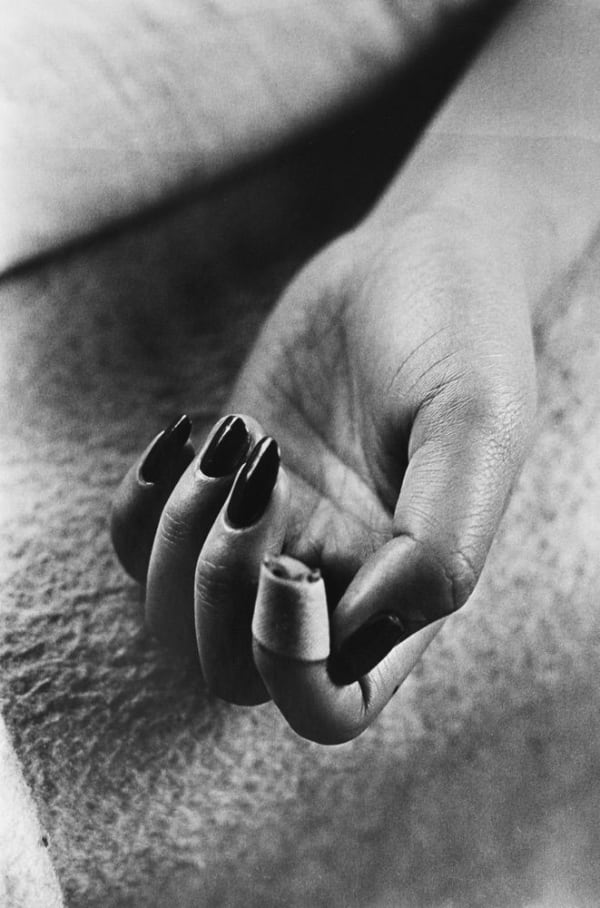 Daido Moriyama, Bandaged Finger, 1987
