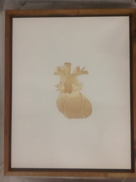 Tommy Grace, Capillary Will