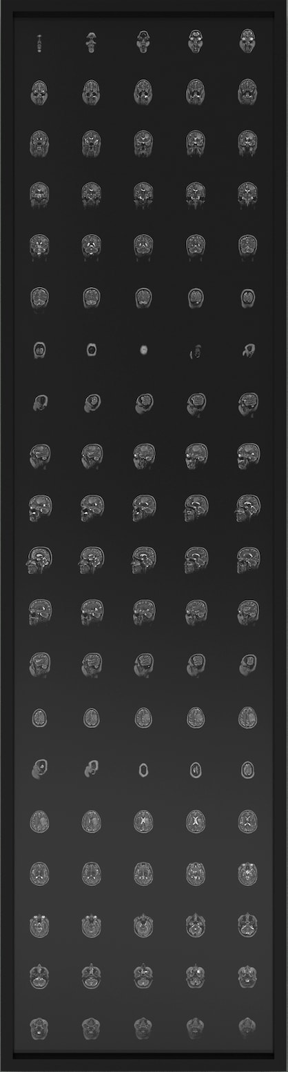 Bandu Darmawan, Radiophobia, 2024