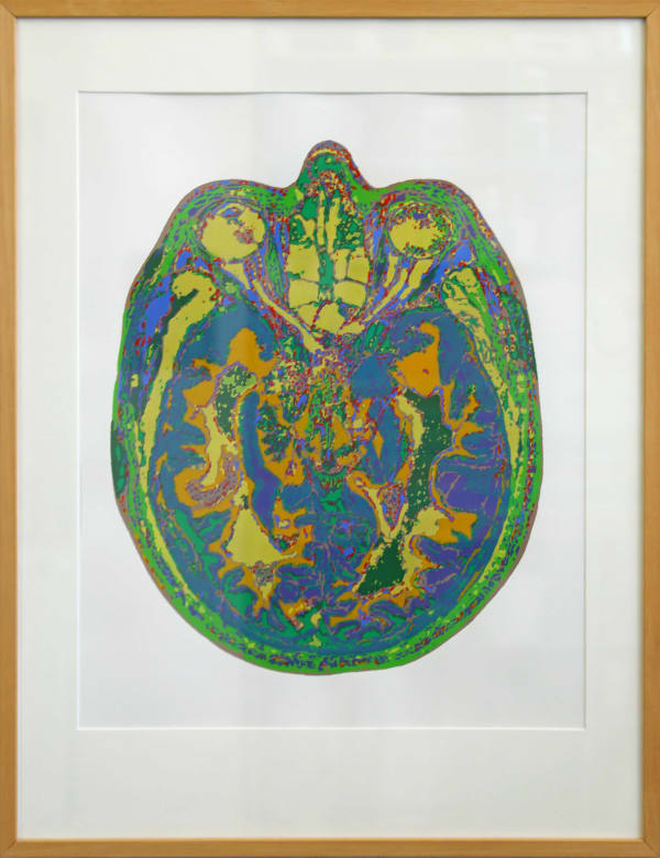 Stéphane Belzère, Cerveaux IRM (série 9 n°4), 2012