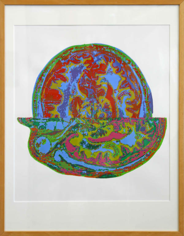 Stéphane Belzère, Cerveaux IRM (série 5 n°4), 2012