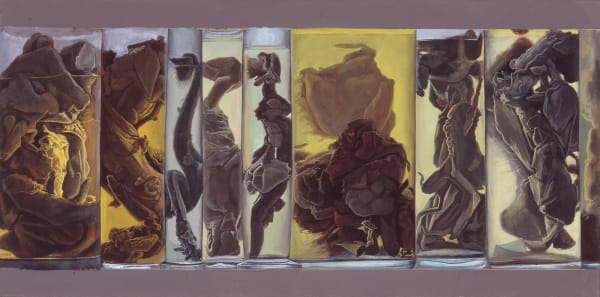 Stéphane Belzère, Bocaux anatomiques n°29, 1996-2003