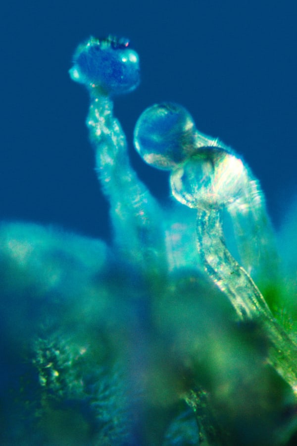Mel Frank, Capitate-Stalked Resin Glands, Thai Stick, Photomicrograph X100, 1979