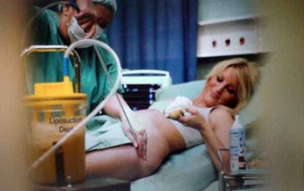 Alison Jackson, Britney has Lipo, 2007