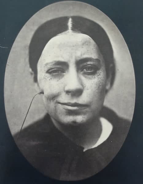 Dr. Guillaume Duchenne (de Boulogne), Rire faux (False laugh) from Mécanisme de la physionomie humaine, 1862