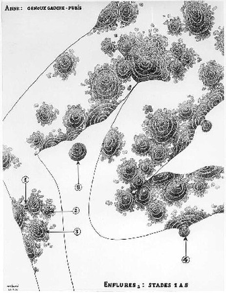 Robert Malaval Anne : genou gauche - Pubis dessin à l'encre de chine sur papier 64 x 50 cm