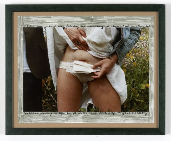 Ed Templeton Dakota open wound w/paint around edges Photo with text