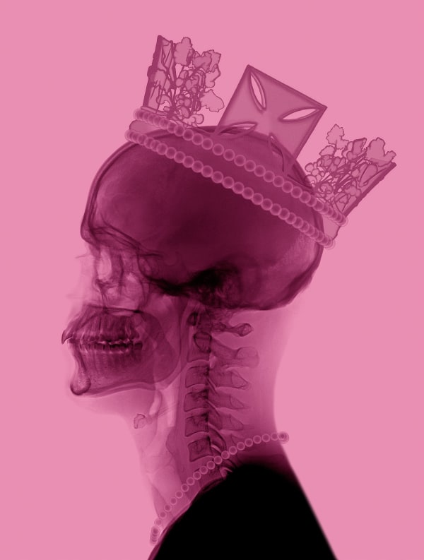 Ernesto Romano, Royal Blood XL (Pink), 2022