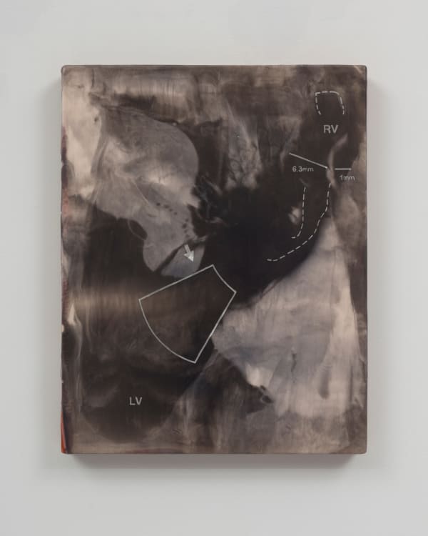 Sean Shim-Boyle, The house, the cars, and the kids’ tuition, 2024