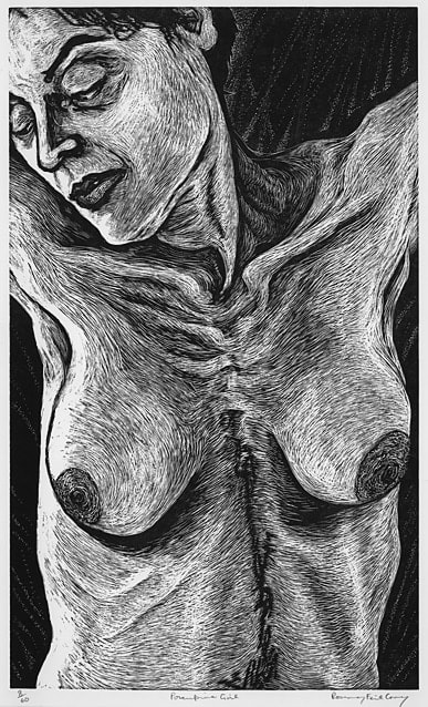 Rosemary Feit Covey, Porcupine Girl (Torso), 1999